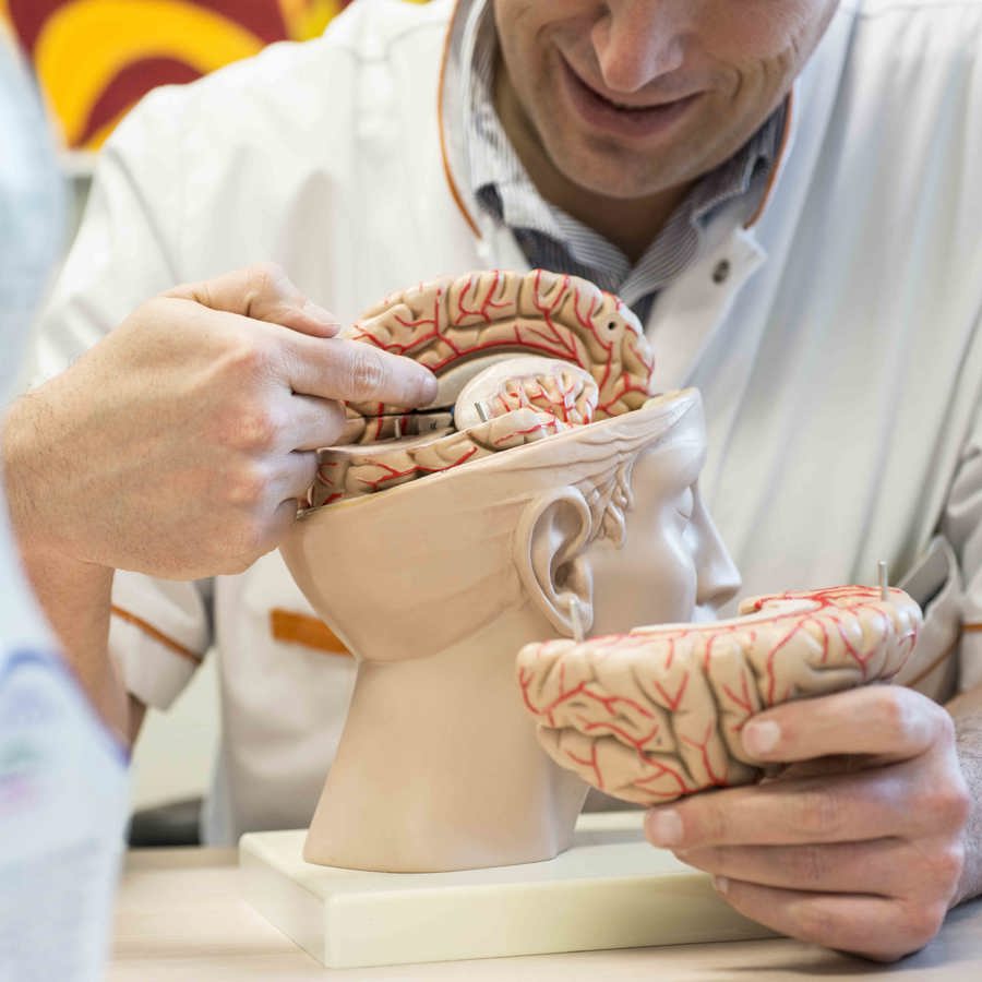 arts met anatomiemodel van de hersenen