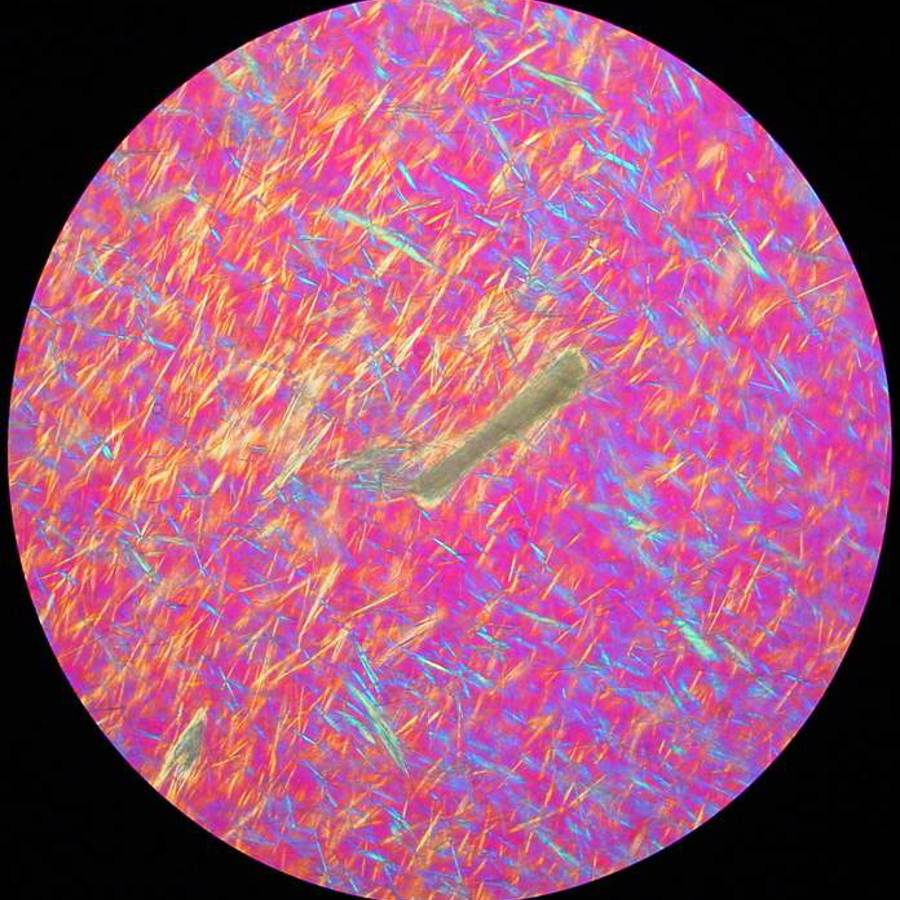 Microscopisch beeld van jichtkristallen